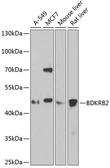 Anti-BDKRB2 antibody used in Western Blot (WB). GTX64939