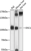 Anti-DSC1 antibody used in Western Blot (WB). GTX64970