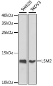 Anti-LSM2 antibody used in Western Blot (WB). GTX65872