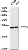 Anti-VPS29 antibody used in Western Blot (WB). GTX65880