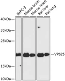 Anti-VPS25 antibody used in Western Blot (WB). GTX65881