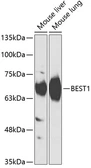Anti-Bestrophin 1 antibody used in Western Blot (WB). GTX65886