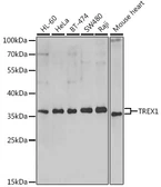 Anti-TREX1 antibody used in Western Blot (WB). GTX65894