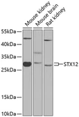 Anti-STX12 antibody used in Western Blot (WB). GTX65901