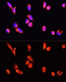 Anti-Annexin III antibody used in Immunocytochemistry/ Immunofluorescence (ICC/IF). GTX65903