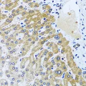 Anti-CPA6 antibody used in IHC (Paraffin sections) (IHC-P). GTX65936