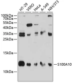 Anti-S100A10 antibody used in Western Blot (WB). GTX65938