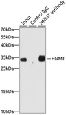 Anti-HNMT antibody used in Immunoprecipitation (IP). GTX65997