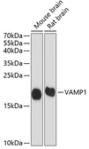 Anti-VAMP1 antibody used in Western Blot (WB). GTX66029