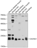 Anti-Cav gamma 1 antibody used in Western Blot (WB). GTX66046