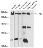Anti-STAB2 antibody used in Western Blot (WB). GTX66047