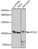 Anti-SCYL2 antibody used in Western Blot (WB). GTX66175