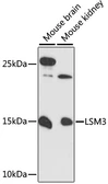 Anti-LSM3 antibody used in Western Blot (WB). GTX66179
