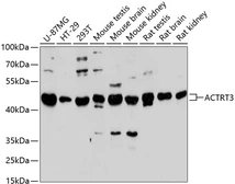 Anti-ARPM1 antibody used in Western Blot (WB). GTX66182