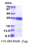 Human LZIC protein, His tag. GTX66212-pro