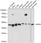 Anti-Neuroguidin antibody used in Western Blot (WB). GTX66264