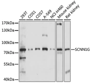 Anti-ENaC Gamma antibody used in Western Blot (WB). GTX66332