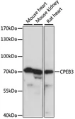 Anti-CPEB3 antibody used in Western Blot (WB). GTX66374