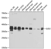 Anti-Connexin 36 antibody used in Western Blot (WB). GTX66420
