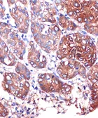 Anti-LYPLA1 antibody used in IHC (Paraffin sections) (IHC-P). GTX66442