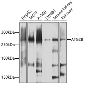 Anti-ATG2B antibody used in Western Blot (WB). GTX66527