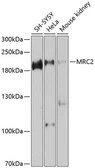 Anti-Endo180 antibody used in Western Blot (WB). GTX66584