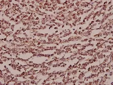 Anti-Endo180 antibody used in IHC (Paraffin sections) (IHC-P). GTX66679
