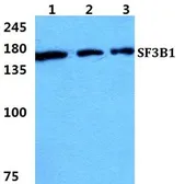 Anti-SF3B1 antibody used in Western Blot (WB). GTX66743