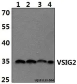 Anti-VSIG2 antibody used in Western Blot (WB). GTX66808