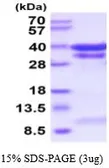 Mouse Cathepsin B protein, His tag (active). GTX66939-pro