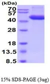 Mouse Cathepsin D protein, His tag (active). GTX66940-pro