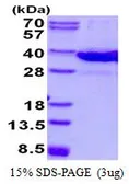 Mouse Galectin 8 protein, His tag (active). GTX67004-pro
