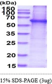 Human AKT1 protein, His tag. GTX67206-pro