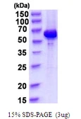 Human AKT1 protein, His tag. GTX67207-pro