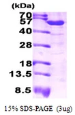 Human ALDH1A1 protein. GTX67209-pro