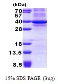 Human CDK3 protein, His tag. GTX67283-pro