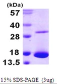 Human Galectin 10 protein, His tag. GTX67304-pro