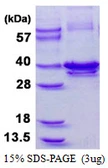 Human Calponin-1 protein, His tag. GTX67310-pro