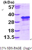 Human eIF4E protein, His tag. GTX67372-pro