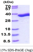Human GPD1 protein. GTX67428-pro
