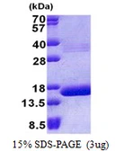 Human Hemoglobin theta 1 protein, His tag. GTX67455-pro
