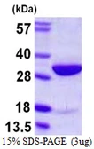 Human HMGB2 protein, His tag. GTX67465-pro