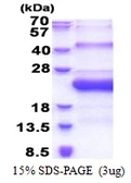 Human SMCP protein, His tag. GTX67548-pro