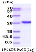 Human MYL4 protein, His tag. GTX67570-pro