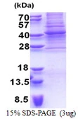 Human PAX9 protein, His tag. GTX67614-pro
