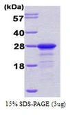 Human IPP1 protein, His tag. GTX67661-pro