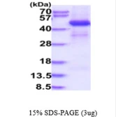 Human MEK1 protein, His tag. GTX67682-pro