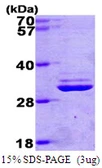Human PSMA7 protein, His tag. GTX67695-pro