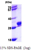 Human RAB27B protein, His tag. GTX67729-pro
