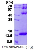 Human DYNLT3 protein, His tag. GTX67879-pro